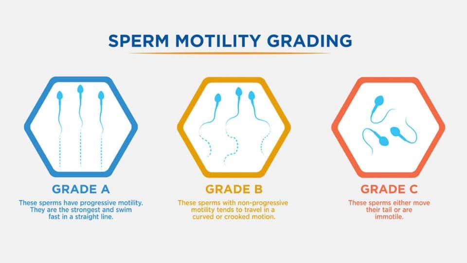 Motility Diagnosis Process