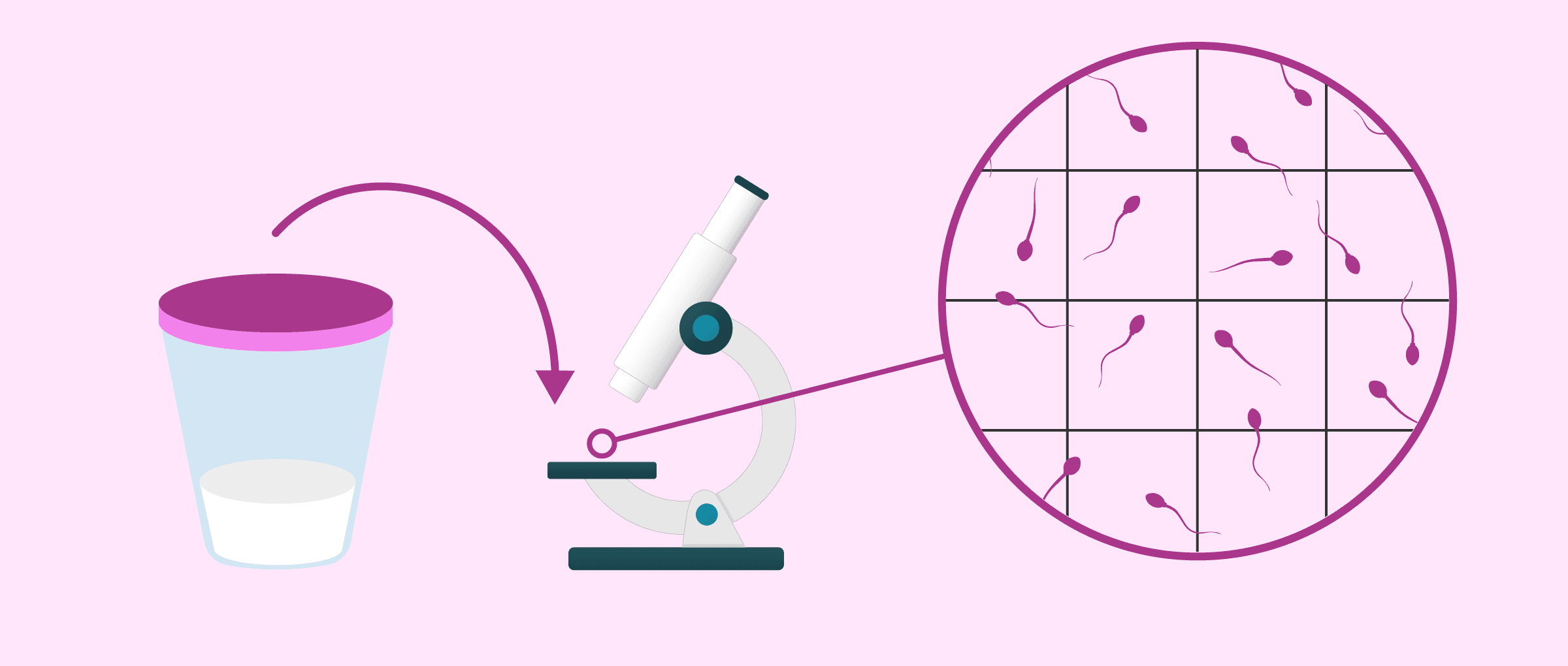 Oligospermia Diagnosis Process