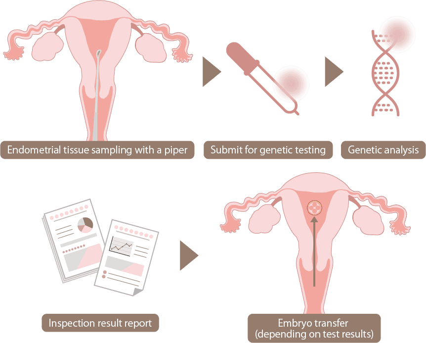 ERA test consultation