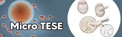 Micro TESE