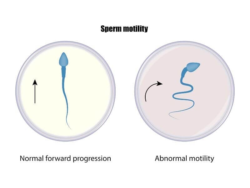 Sperm Motility Analysis
